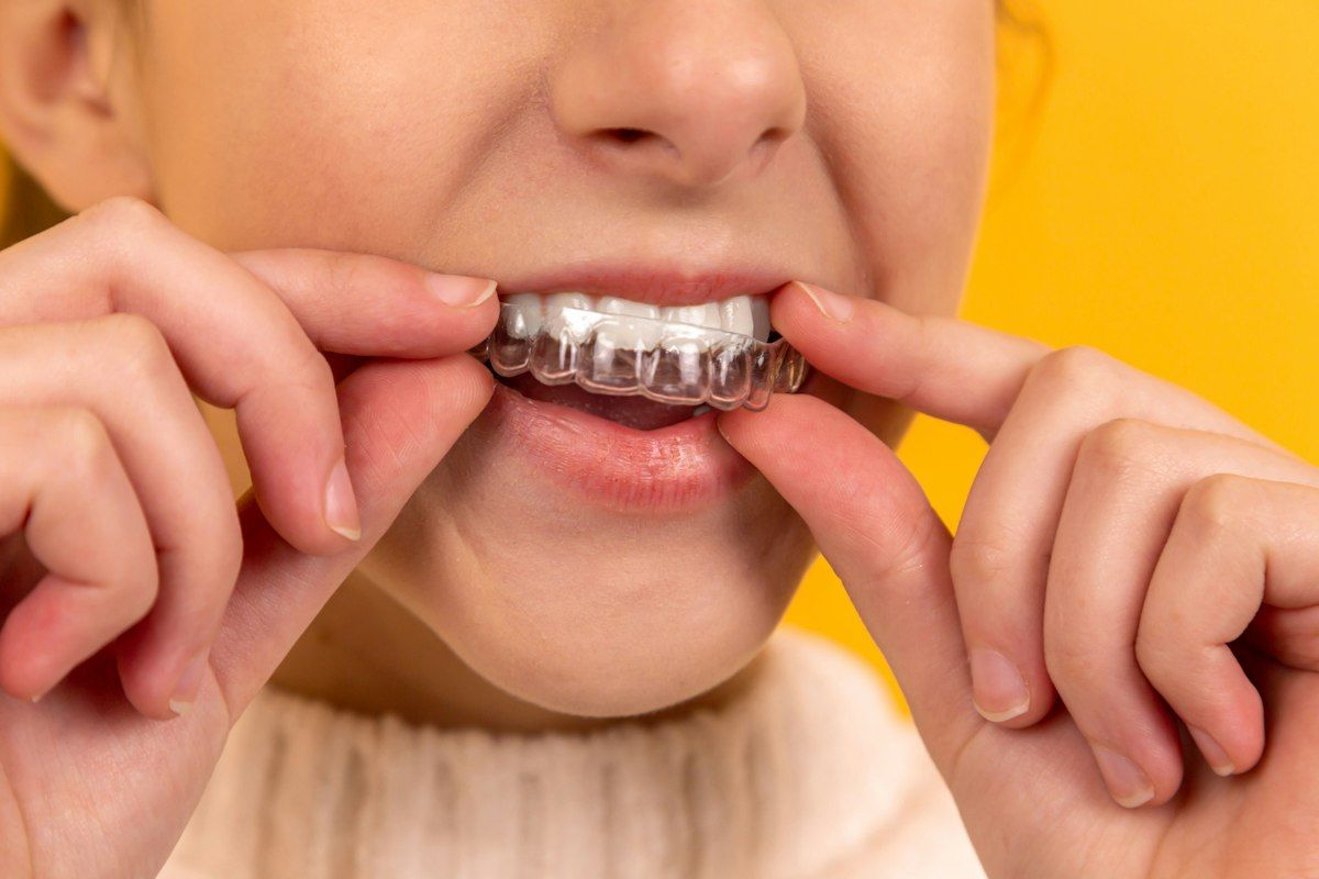 Treatment: Whitening
